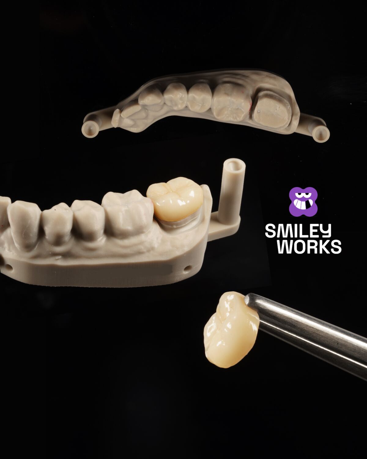 Single Crowns. Crafted to Blend Seamlessly.