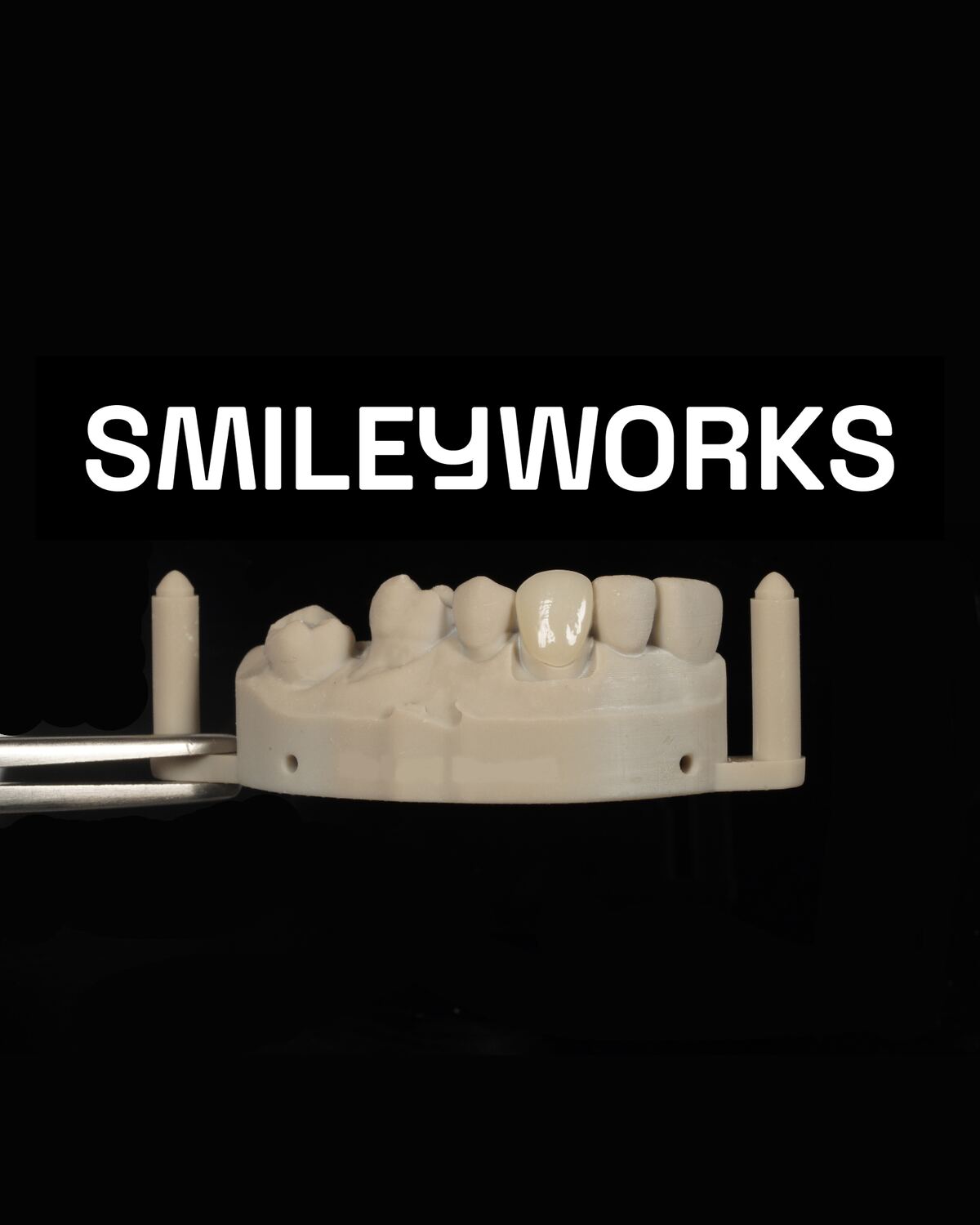 Precision Crown & Bridge Restorations.