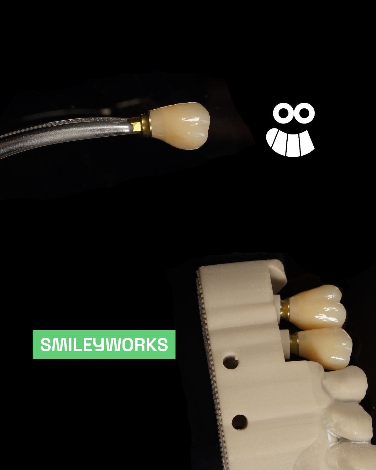 Implant Crowns, Perfected.