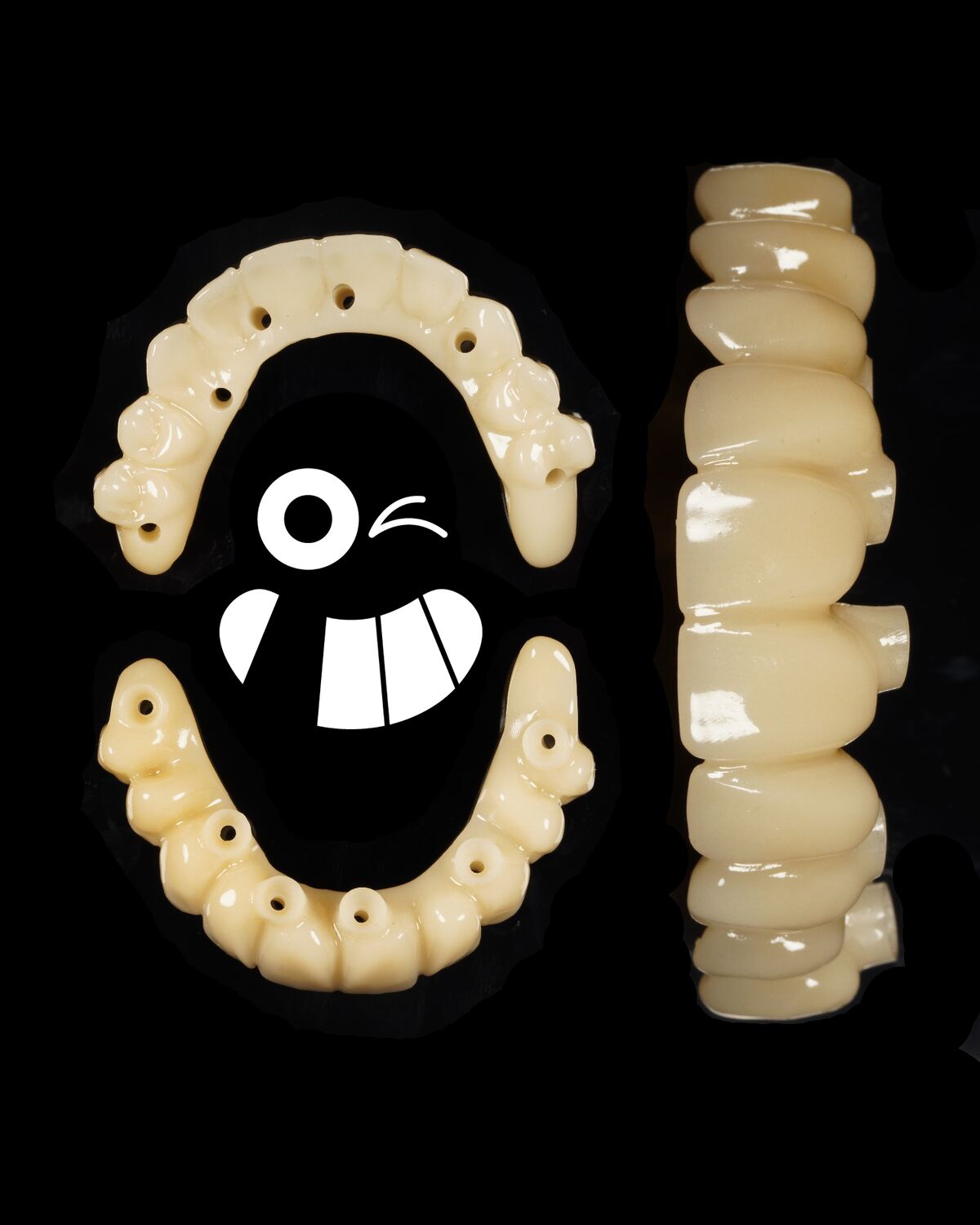 Full Arch PMMA Restorations.