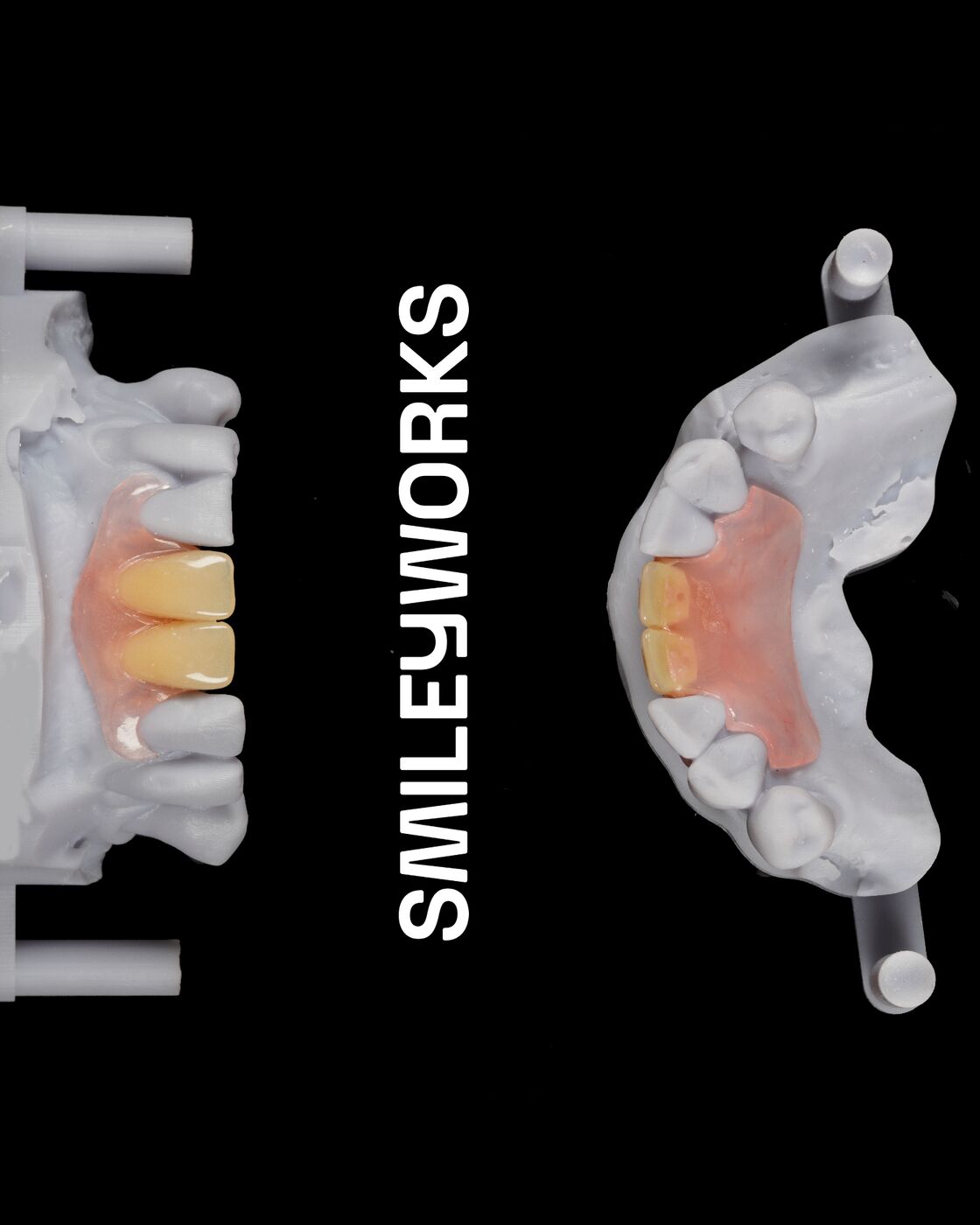 Natural-Looking Dentures for Everyday Confidence.
