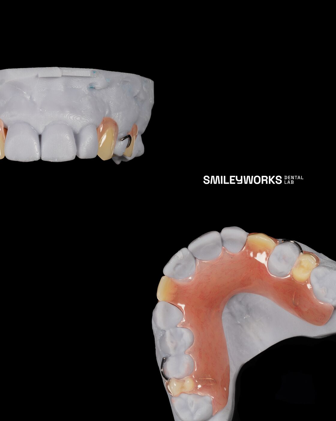 Comfortable Dentures, Made to Feel Natural.