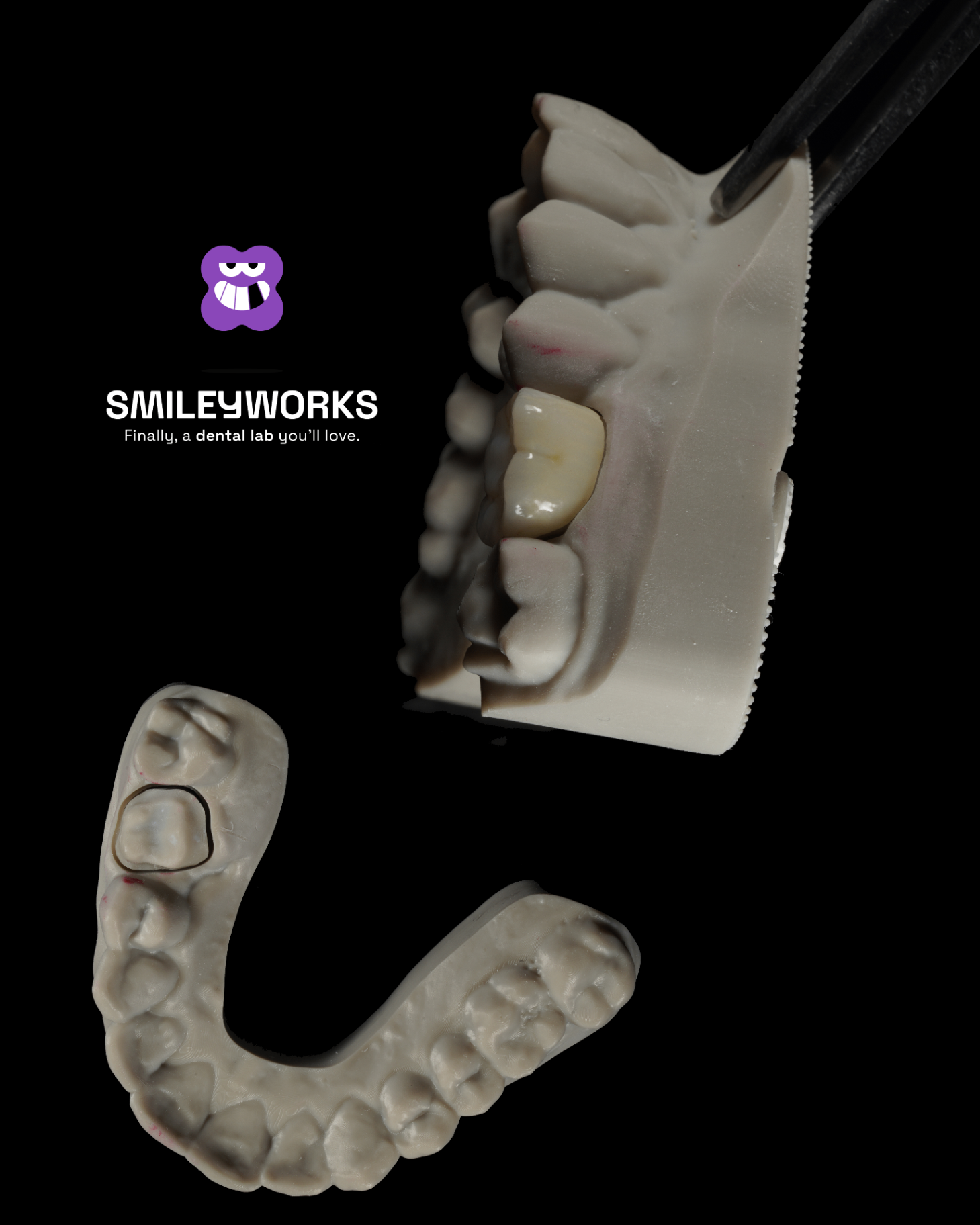 Monolithic Zirconia Crown