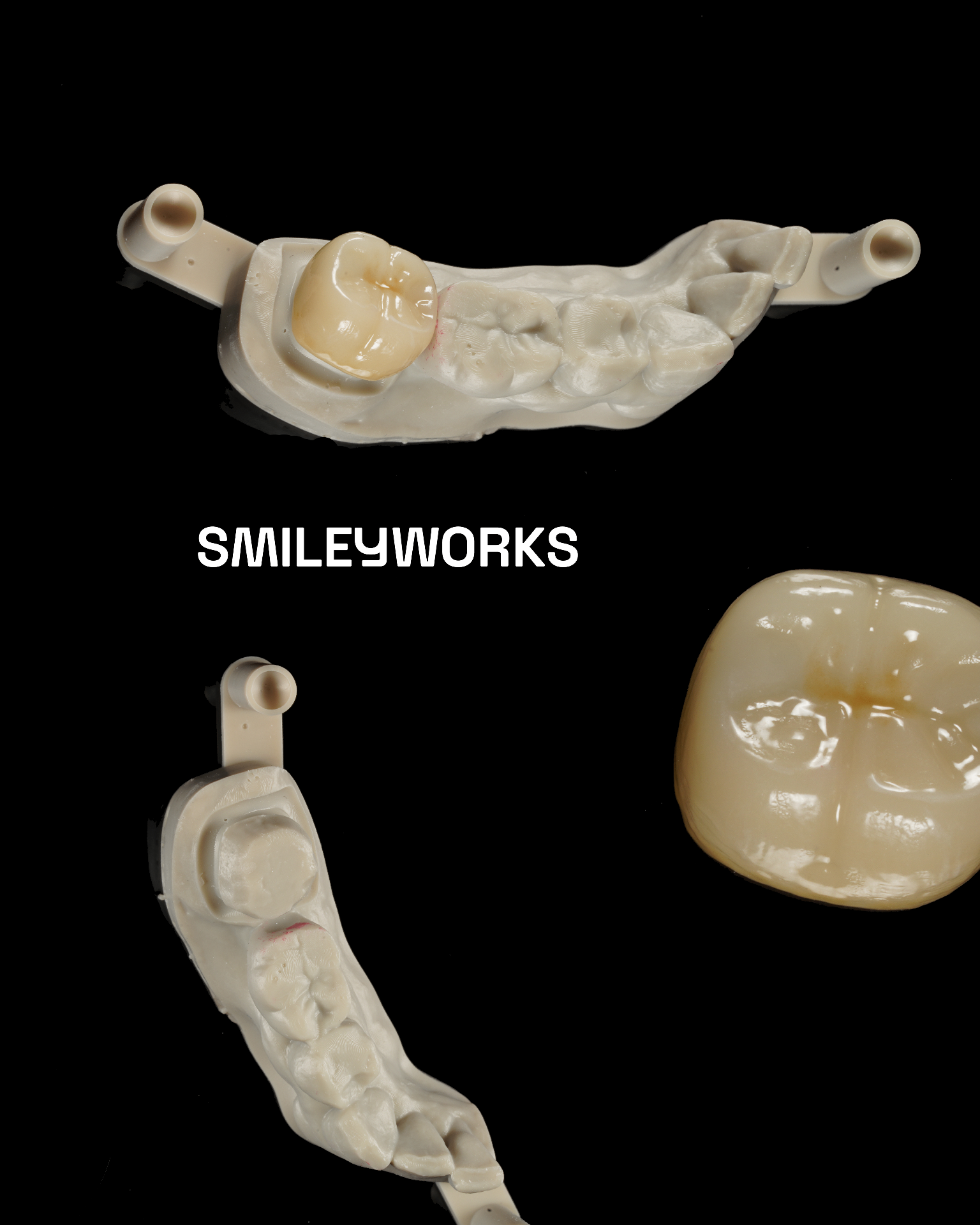 Monolithic Zirconia Crown