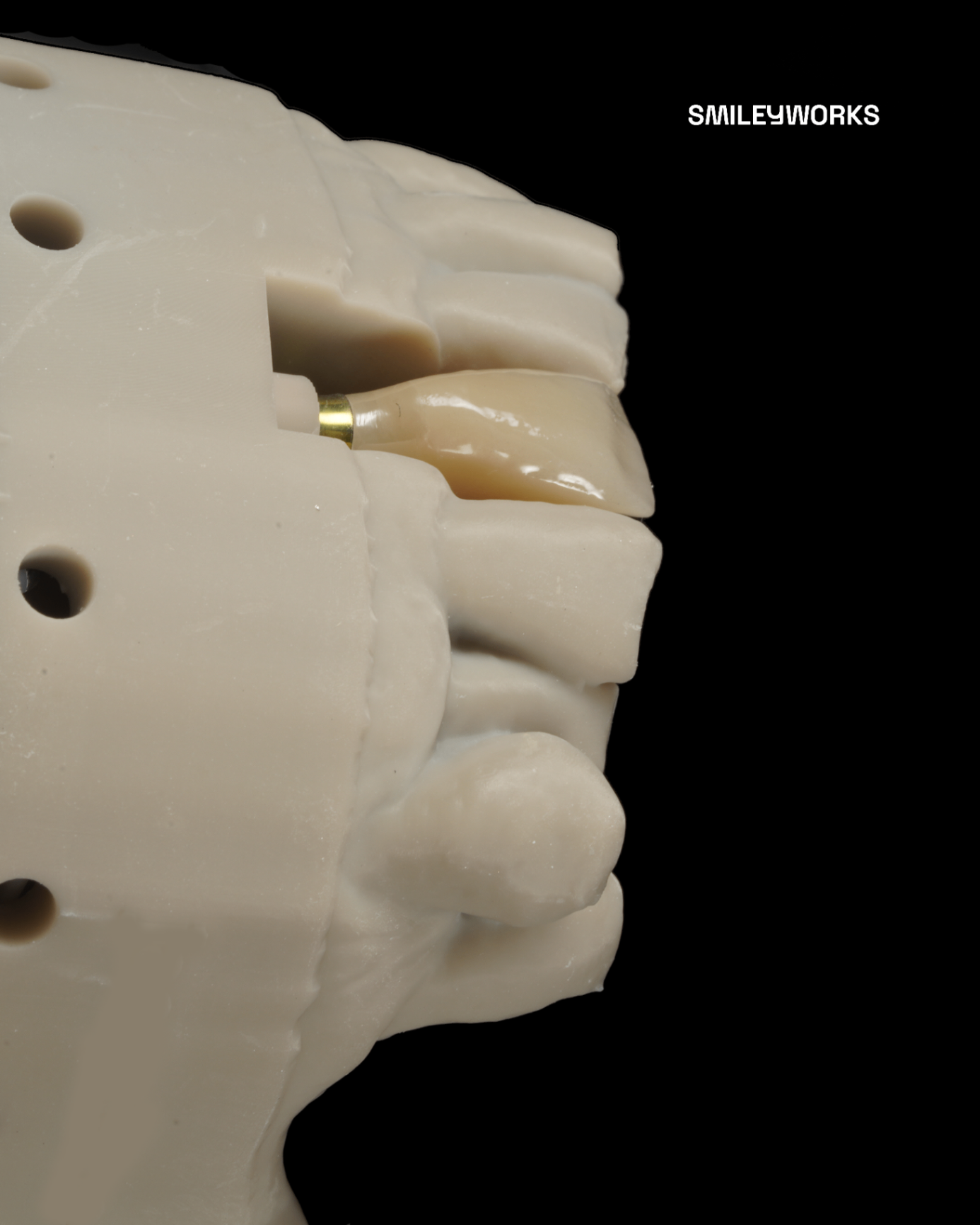 JD Evolution Implant